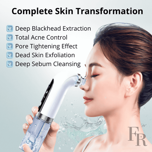 Professional Pore Vacuum & Skin Rejuvenation Kit - FRNESS